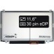 Display Acer Aspire V5-123 SERIES Displej LCD 11,6“ 30pin eDP HD LED Slim - Lesklý
